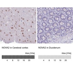 Nova2 Antibody, Novus Biologicals 0.1mL; Unlabeled:Antibodies, Polyclonal